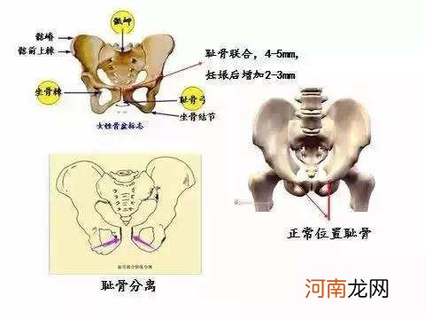 耻骨是哪里 耻骨是哪里图片