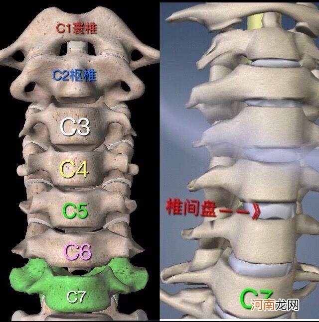 颈椎是哪里 第七颈椎是哪里