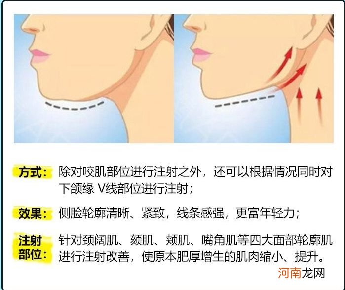 下颌是哪里 下颌是哪里?