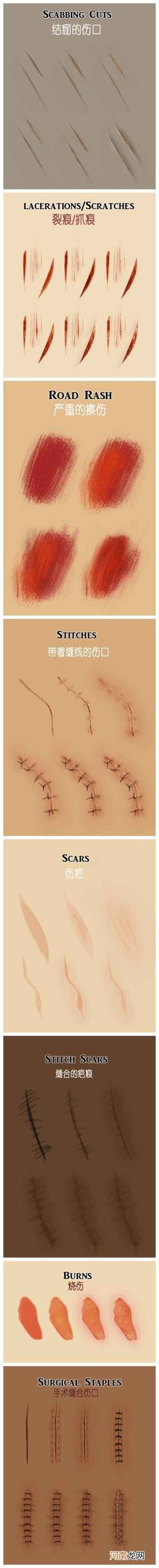 伤口怎样不留疤痕 怎么样伤口不留疤痕