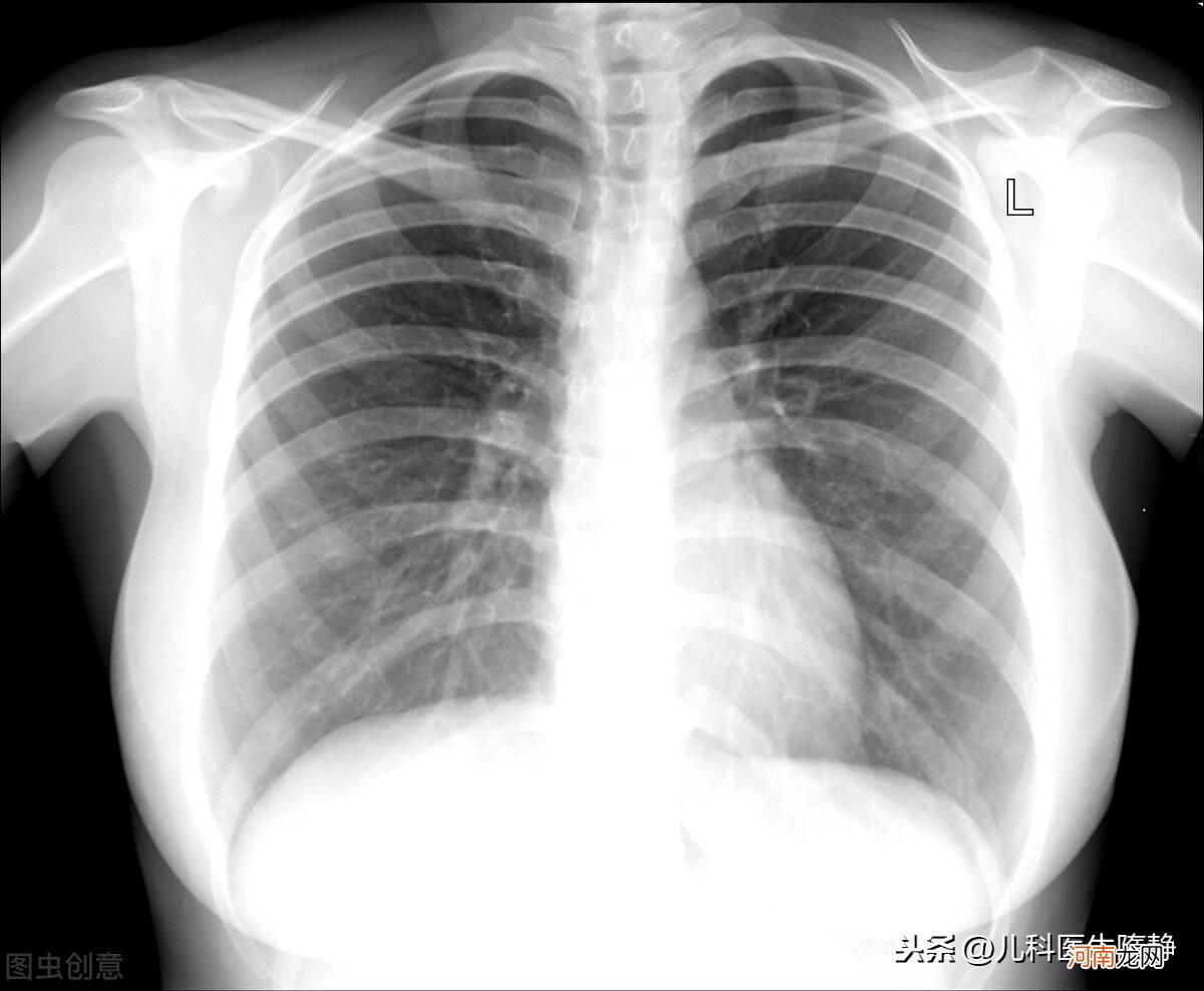 气管和肺的连接处叫什么 哪里是气管