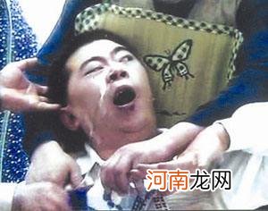 哪里治疗癫痫 痫病可以治愈吗