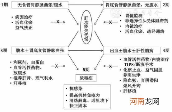 得了肝硬化还可以活多久？ 肝硬化会死吗