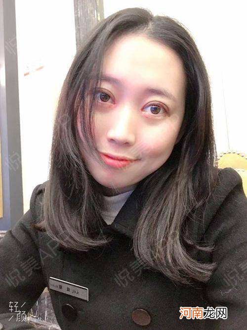 双眼皮哪里做的好深圳 双眼皮哪里做的好