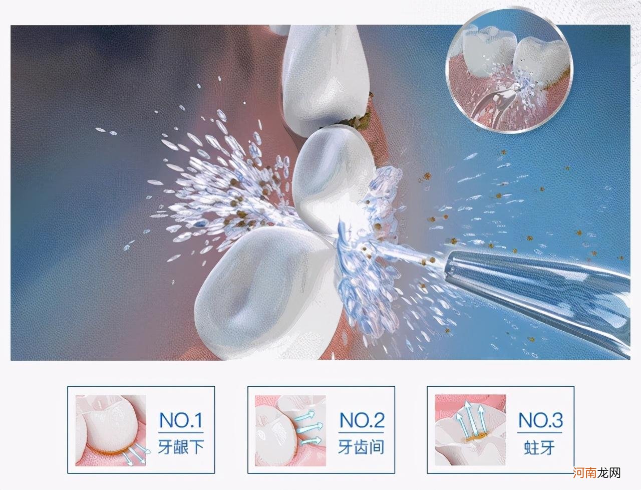 3种牙线使用详细步骤及注意事项 牙线的使用方法图解法