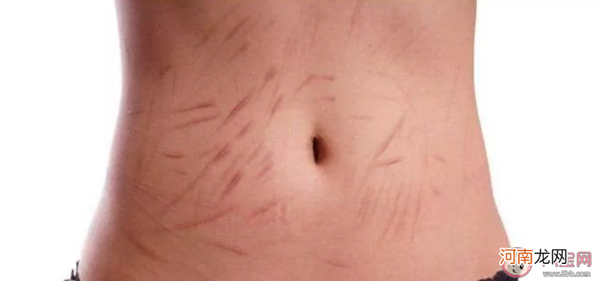 疤痕体质|疤痕体质的说法靠谱吗 疤痕体质能改变吗