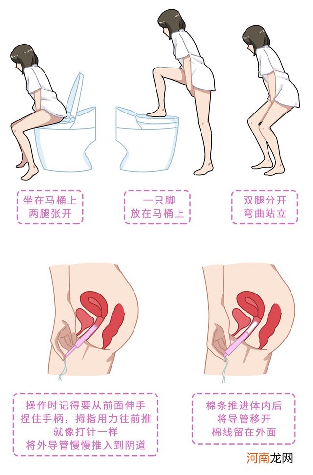 卫生棉条和卫生巾有区别吗 卫生棉条的正确使用方法是什么