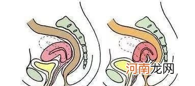产后子宫没恢复好都有哪些表现 产后子宫恢复不好的症状有什么